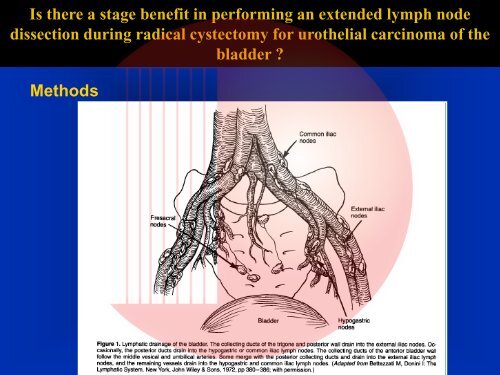 Muscle Invasive Bladder Cancer