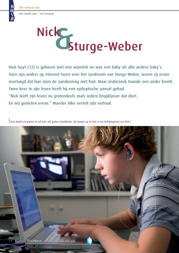 Sturge-Weber - Huid Magazine