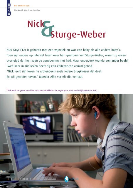 Sturge-Weber - Huid Magazine