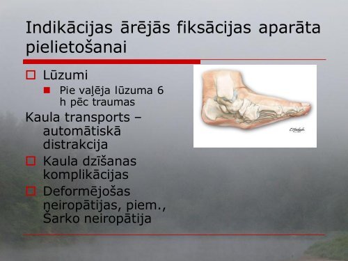 ÄrÄjÄ fiksÄcija ortopÄdijÄ