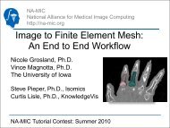 Image to Finite Element Mesh: An End to End Workflow - 3D Slicer