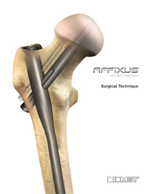 https://img.yumpu.com/50679142/1/500x640/affixusaar-hip-fracture-nail-surgical-technique-biomet.jpg