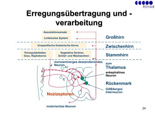 GBS/CIDP: Schmerztherapie - Guillain-Barré Syndrom