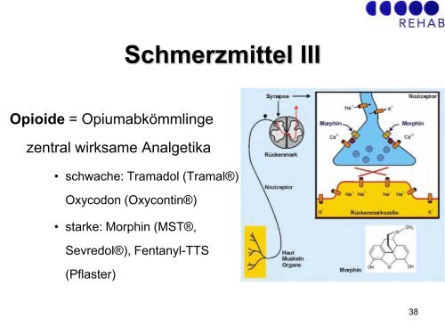 GBS/CIDP: Schmerztherapie - Guillain-Barré Syndrom