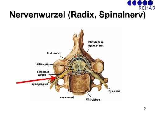 GBS/CIDP: Schmerztherapie - Guillain-Barré Syndrom