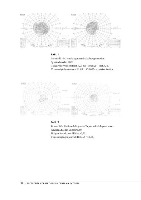 Excentrisk korrektion vid centrala scotom - Certec - Lunds Tekniska ...