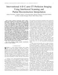 Interventional 4-D C-Arm CT Perfusion Imaging Using Interleaved ...