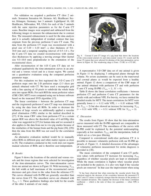 Interventional 4-D C-Arm CT Perfusion Imaging Using Interleaved ...