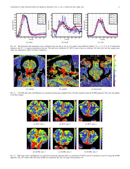 Interventional 4-D C-Arm CT Perfusion Imaging Using Interleaved ...