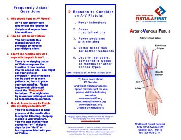 ArterioVenous Fistula - Northwest Renal Network