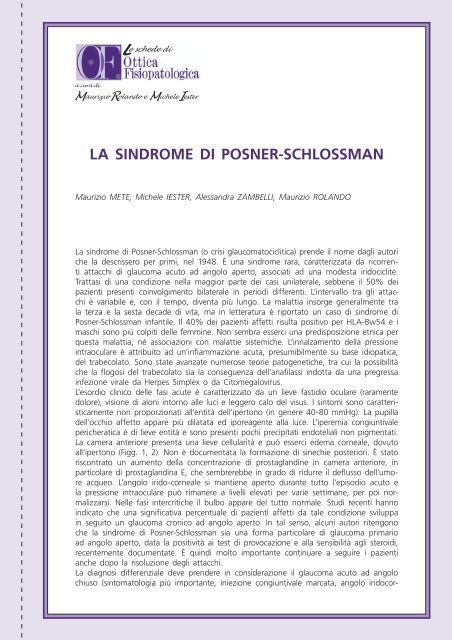 Sindrome di Posner-Schlossman - NuovaVistaInformata