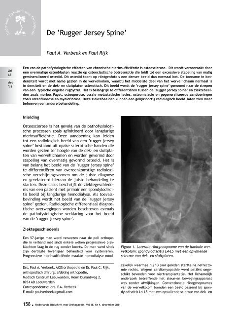 ONederlands Tijdschrift voor - Nederlands Tijdschrift voor Orthopaedie