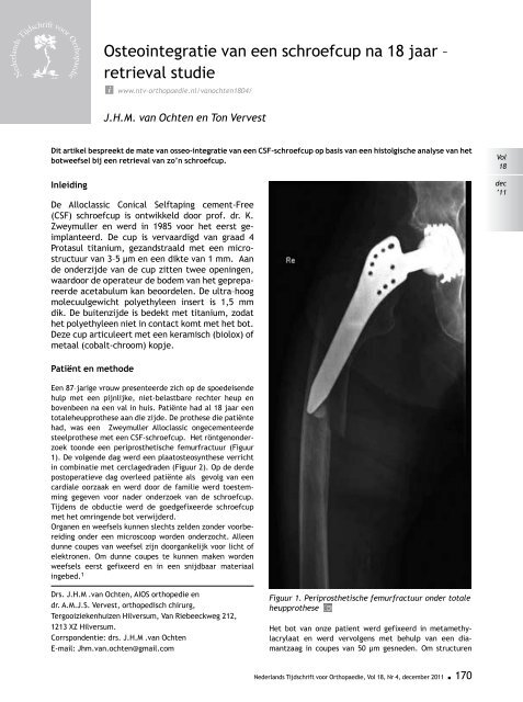 ONederlands Tijdschrift voor - Nederlands Tijdschrift voor Orthopaedie