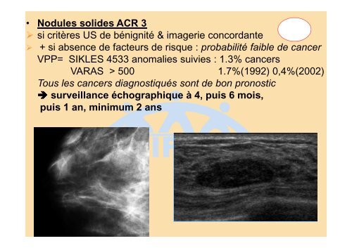 Score BI-RADS de l'ACR et CAT