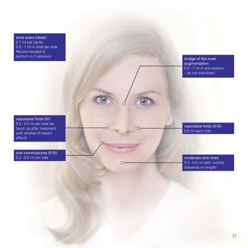 SYSTEMATIC HYALURONIC ACID GELS Dosage ... - Skin & Vision