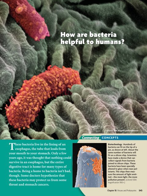 18.1 Studying Viruses and Prokaryotes