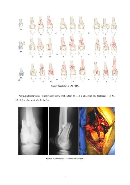 Ouvrir le document (PDF) - desc orthopedie