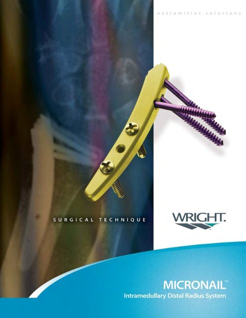 MICRONAILT Distal Radius Implant .pdf - Osteosyntese
