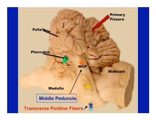 Cerebellum