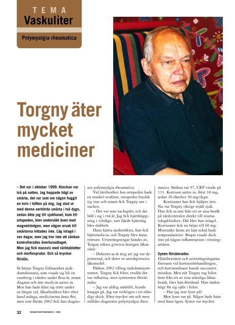 32 Tema Vaskuliter Polymyalgia rheumatica - VÃ¤lkommen till ...