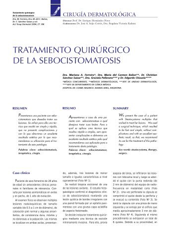 tratamiento quirÃºrgico de la sebocistomatosis - Actualizaciones ...