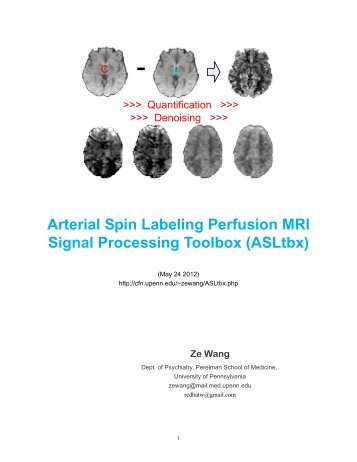 Arterial Spin Labeling Perfusion MRI Signal Processing Toolbox ...