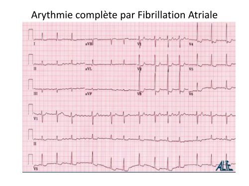 ECGâ¦