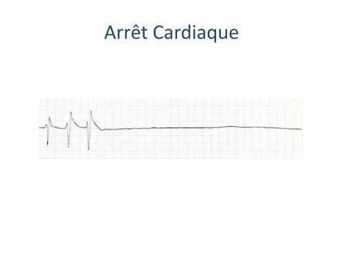 ECGâ¦