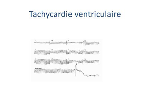 ECGâ¦