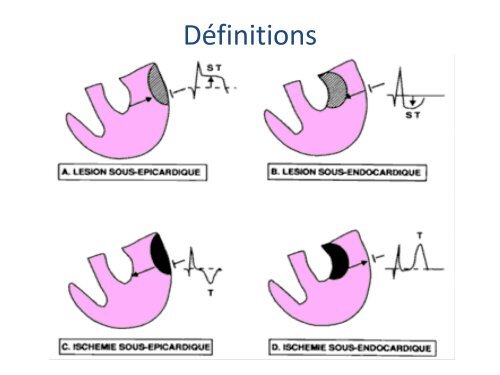 ECGâ¦