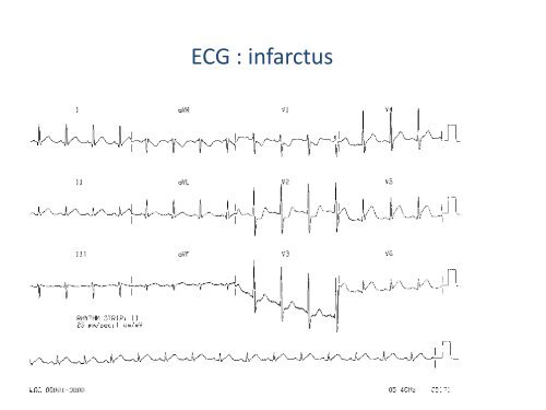 ECGâ¦