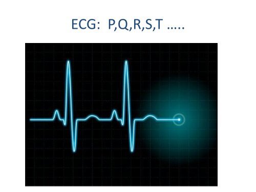 ECGâ¦