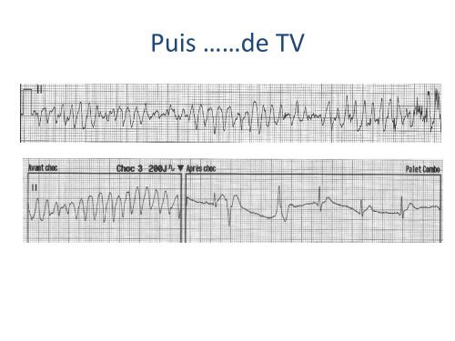 ECGâ¦