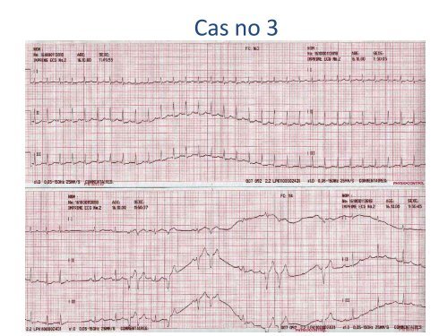 ECGâ¦