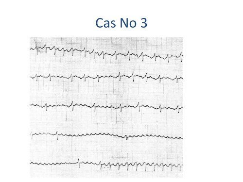 ECGâ¦