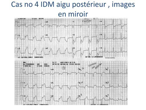 ECGâ¦