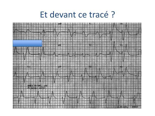 ECGâ¦