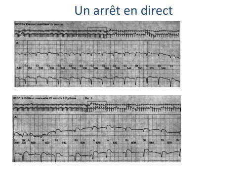 ECGâ¦