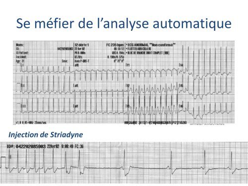 ECGâ¦