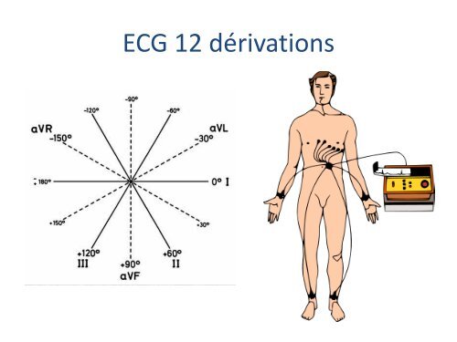 ECGâ¦