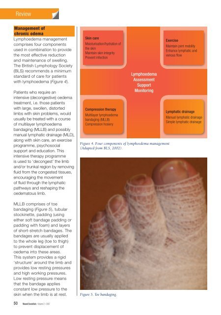 leg ulcer management in patients with chronic oedema - Wounds ...