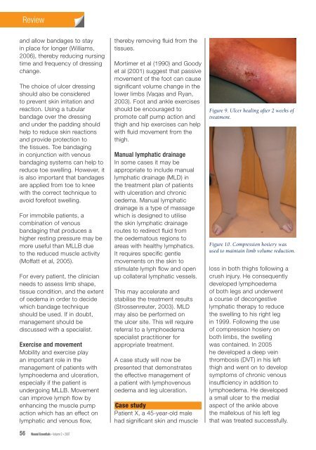 leg ulcer management in patients with chronic oedema - Wounds ...