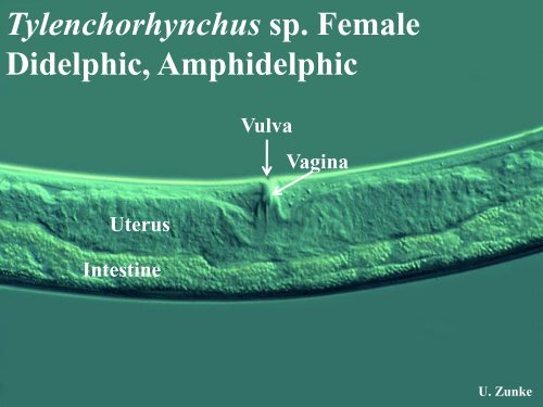 NEMATODE STRUCTURE -Used to identify nematodes -Identifying ...