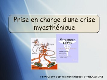 Prise en charge d'une crise myasthénique