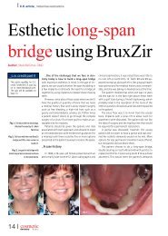 Esthetic long-span bridgeusing BruxZir