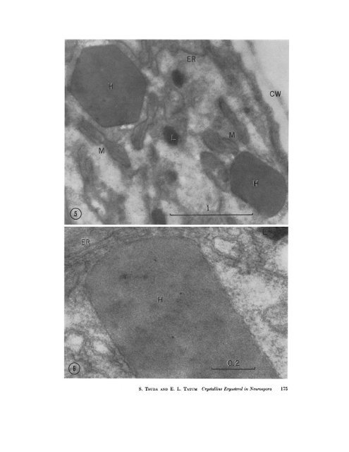 INTRACELLULAR CRYSTALLINE ERGOSTEROL IN NEUROSPORA