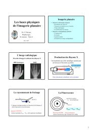 Les bases physiques de l'imagerie planaire