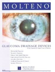 Glaucoma Drainage Devices - Eyetube.net