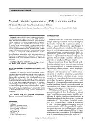 Mapas de estadísticos paramétricos (SPM) en medicina nuclear