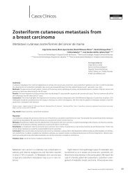 Zosteriform cutaneous metastasis from a breast ... - edigraphic.com